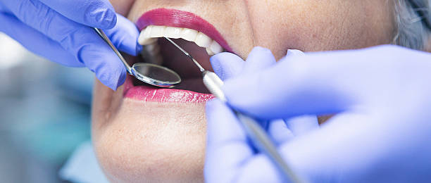 Best Emergency Dentist for Knocked-Out Tooth in Loma Linda, CA
